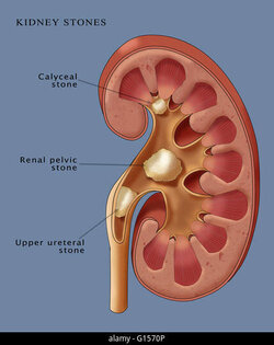 kidney.jpeg