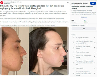 Whats_wrong_forehead1.jpg
