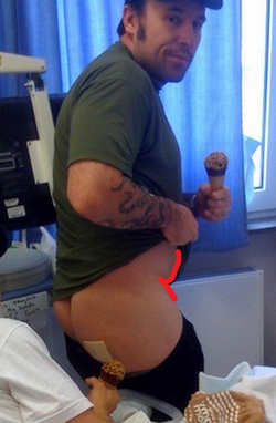 Delta matt pranka fat.png