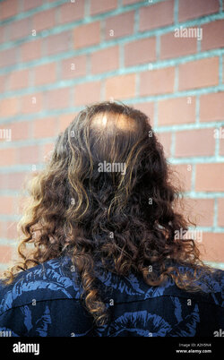back-view-of-man-s-head-with-bald-spot-and-long-shoulder-length-curly-A2H5N4.jpg
