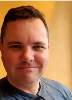bad hairline.PNG