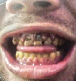 kingcobrajfs teeth.jpg