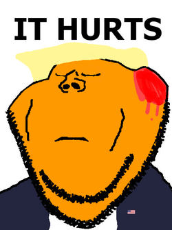 donald trump swedejak ear missing.png