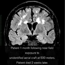 brain.jpg