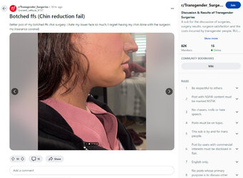 Saggy_jaw2.jpg