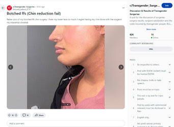 Saggy_jaw4.jpg