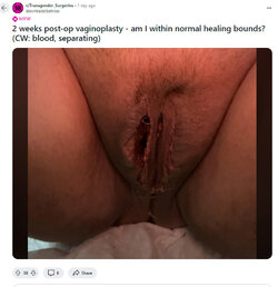 Double_ditch.jpg