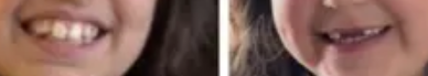 teeth.png