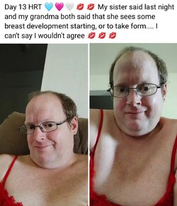 day 13 hrt.jpeg
