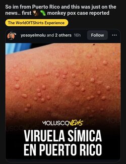 Screenshot_20240817-204730_Reddit.jpg