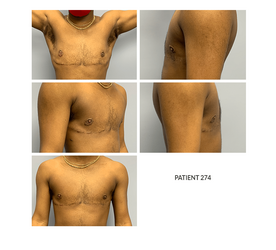 274_TopSurgery.png