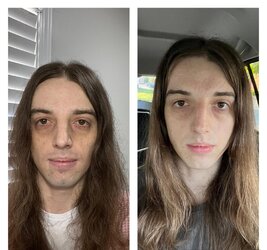i-wanted-to-give-everyone-an-update-on-my-transition-so-v0-fzt2rc28zsjd1.jpeg