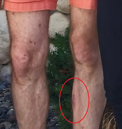nick_crack_legs.png