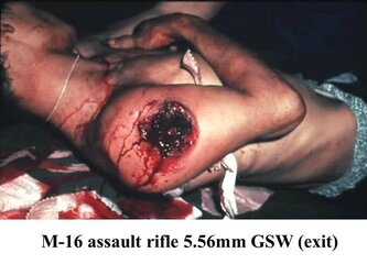 main-qimg-4a12473eca07a80fcee39ff730d8c02b-lq.jpeg