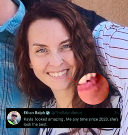 kayla_herpes_ralph_tweet.png