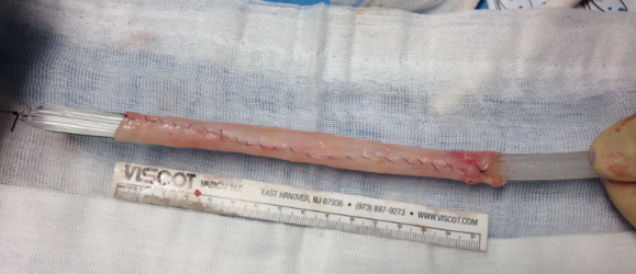 vaginal mucosa urethra.PNG