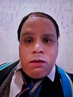 Josh without his clotrimazole.jpeg