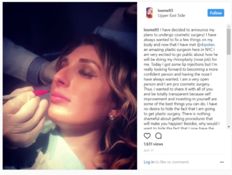 laura-loomer-nose-job4.png