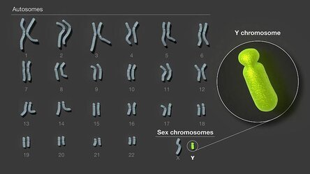 20230823-human-y-chromosome-karyotype.jpg