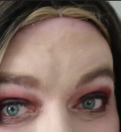 Forehead.jpg