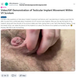 Screenshot 2024-09-30 at 12-27-08 Video_GIF Demonstration of Testicular Implant Movement Withi...png