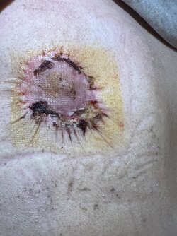 nipple-issue-v0-rogr4vl1a0sd1.jpg