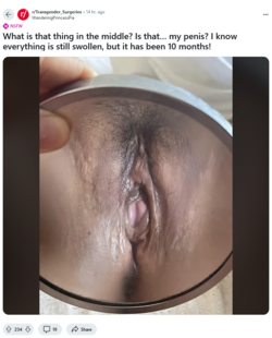 Screenshot 2024-10-05 at 18-13-23 What is that thing in the middle Is that… my penis I know ev...png