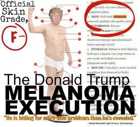 y7a-me-donald_trump_melanoma_execution-grade_f_master.jpg