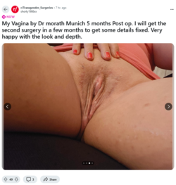 Screenshot 2024-10-08 at 22-14-50 My Vagina by Dr morath Munich 5 months Post op. I will get t...png