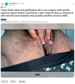 Screenshot 2024-10-11 at 16-06-11 I have both meta and phallodone all in one surgery with part...png