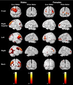 Correlations-P-b-0001-in-men-N-23-and-women-N-25-between-gray-matter-and.png