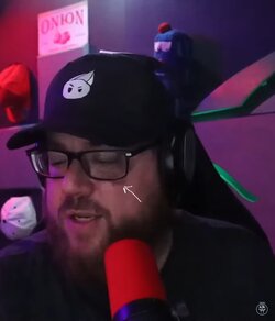 Black eye.jpg