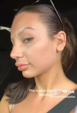 disfigured child 2.png