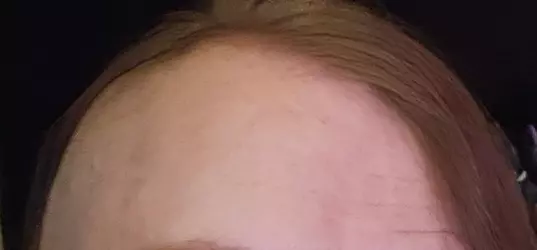 kevhairline.png