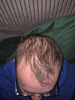 baldy.webp