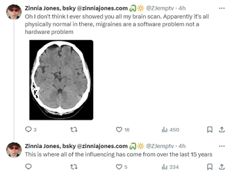brain.jpg