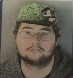 Pre Op Colton.jpg