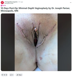 Zero_depth_amhole.jpg