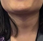 man-jaw.jpg