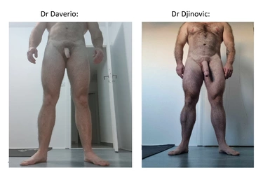Sexe_de_face_debout.jpg