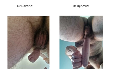 Sexe_contre_plongée.jpg