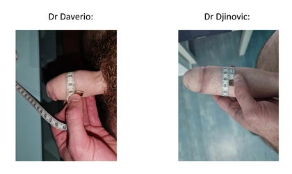 Diamètre_sexe.jpg