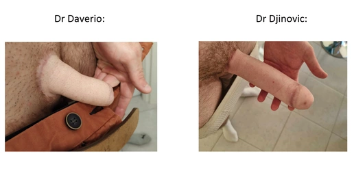 Sexe_de_profil.jpg