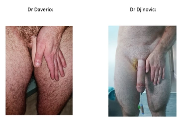 Sexe_de_face.jpg