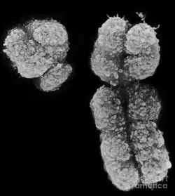 human-x-and-y-chromosomes-biophoto-associates.jpg