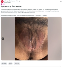 3_labia_dude3.jpg