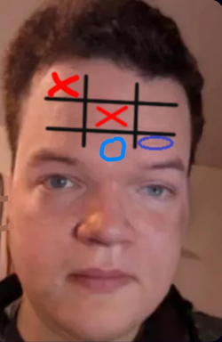 Forehead.jpg