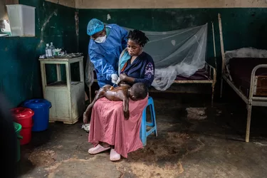 mpox08.jpg mpox08.jpg