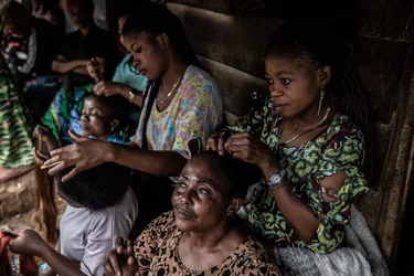 mpox19.jpg mpox19.jpg