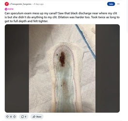 Camel_toe_troon3.jpg